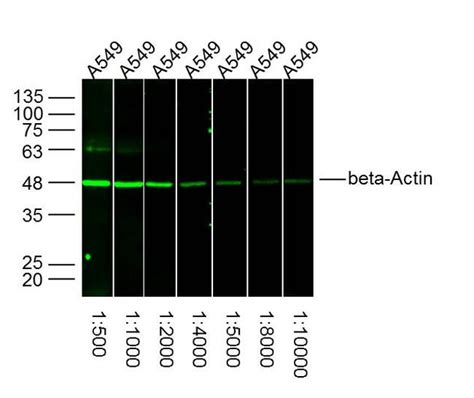 beta actin antibody|beta actin Polyclonal Antibody .